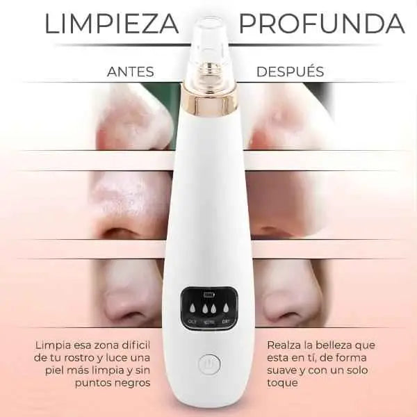 Limpiador Facial de Poros Eléctrico con 6 Cabezales - Suctor de Puntos Negros con Succión Ajustable Pro y Carga USB 2026 - Conecta Chava Shop