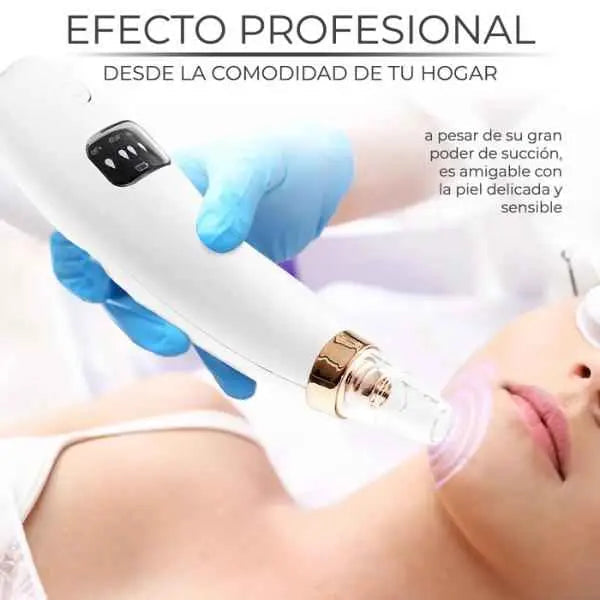 Limpiador Facial de Poros Eléctrico con 6 Cabezales - Suctor de Puntos Negros con Succión Ajustable Pro y Carga USB 2026 - Conecta Chava Shop