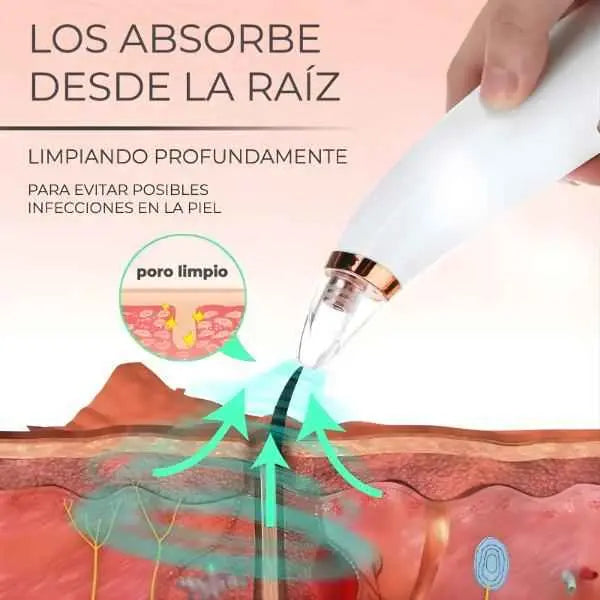 Limpiador Facial de Poros Eléctrico con 6 Cabezales - Suctor de Puntos Negros con Succión Ajustable Pro y Carga USB 2026 - Conecta Chava Shop